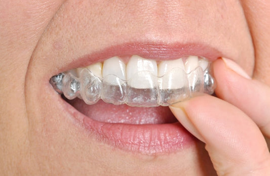 Mai multe despre Ivisalign si Spark